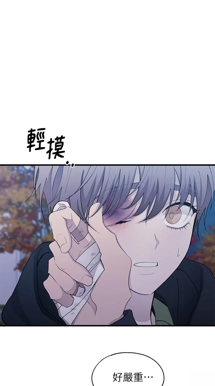 87