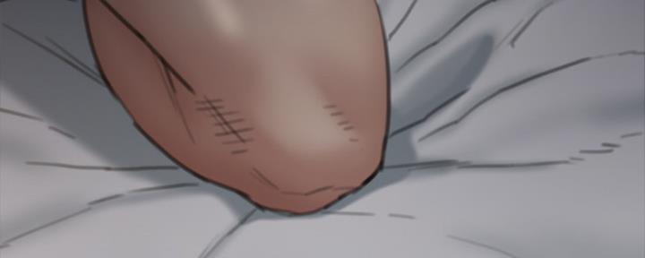 147