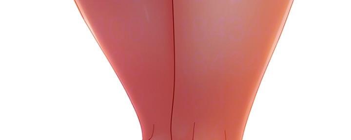 91