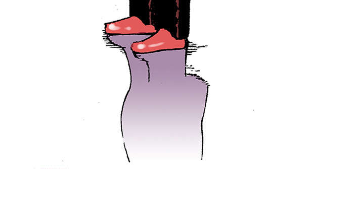 47